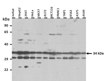 DBP Rabbit Polyclonal Antibody