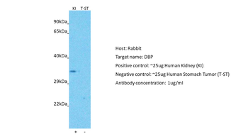 DBP Rabbit Polyclonal Antibody