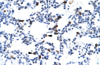 E2F6 Rabbit Polyclonal Antibody