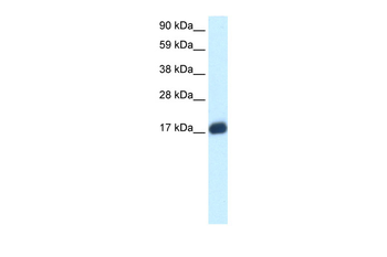 E2F6 Rabbit Polyclonal Antibody