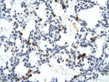 E2F6 Rabbit Polyclonal Antibody
