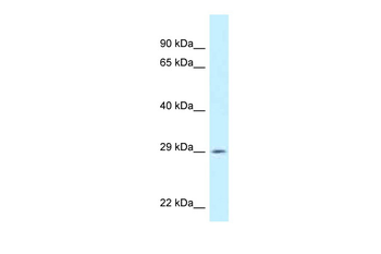 SPIC Rabbit Polyclonal Antibody
