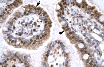 EGR1 Rabbit Polyclonal Antibody