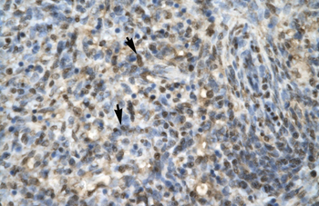EGR1 Rabbit Polyclonal Antibody