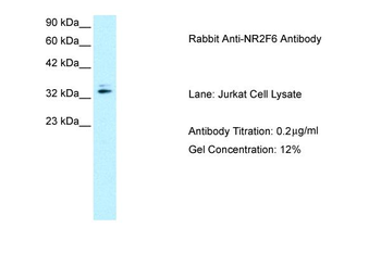 NR2F6 Rabbit Polyclonal Antibody