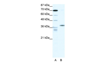 NR2F6 Rabbit Polyclonal Antibody