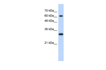 ERF Rabbit Polyclonal Antibody