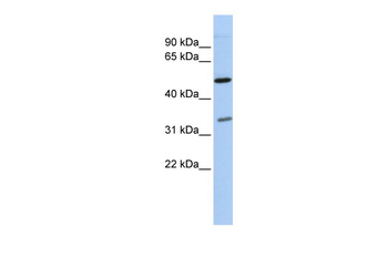 PQBP1 Rabbit Polyclonal Antibody