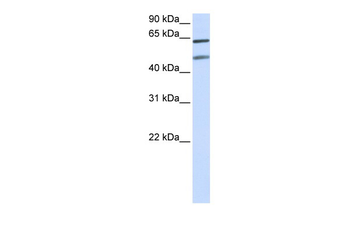 OPTN Rabbit Polyclonal Antibody