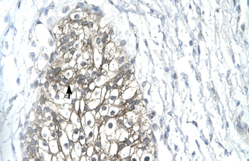 MMP19 Rabbit Polyclonal Antibody