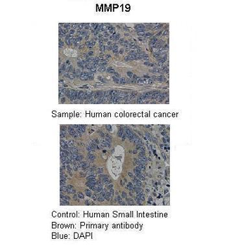 MMP19 Rabbit Polyclonal Antibody
