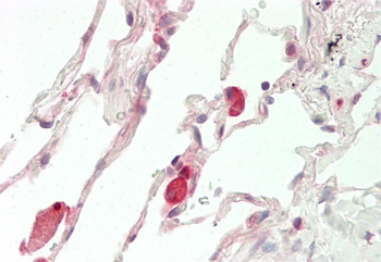 GLI3 Rabbit Polyclonal Antibody