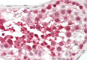 GLI3 Rabbit Polyclonal Antibody