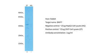 BMP7 Rabbit Polyclonal Antibody
