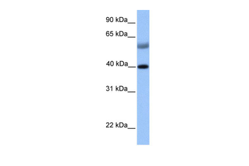 ISL1 Rabbit Polyclonal Antibody