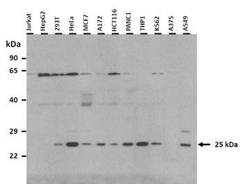 ASCL1 Rabbit Polyclonal Antibody