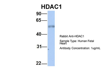 HDAC1 Rabbit Polyclonal Antibody