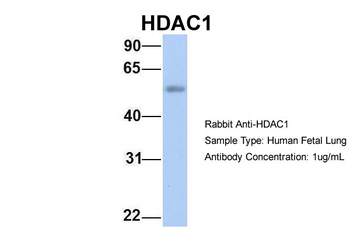 HDAC1 Rabbit Polyclonal Antibody