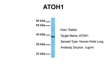 ATOH1 Rabbit Polyclonal Antibody