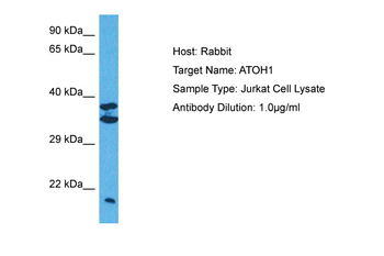 ATOH1 Rabbit Polyclonal Antibody