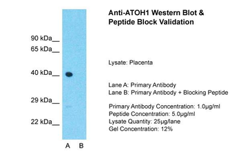 ATOH1 Rabbit Polyclonal Antibody
