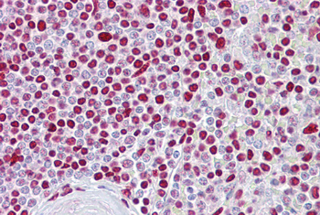 ATOH1 Rabbit Polyclonal Antibody