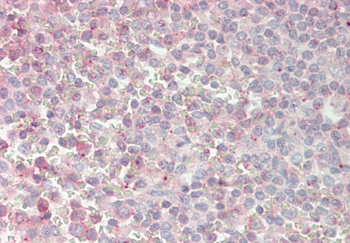 ATOH1 Rabbit Polyclonal Antibody