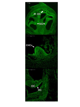 ATOH1 Rabbit Polyclonal Antibody