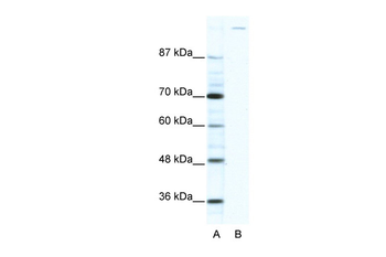 GLI1 Rabbit Polyclonal Antibody