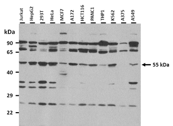 PAX7 Rabbit Polyclonal Antibody