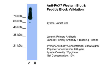 PAX7 Rabbit Polyclonal Antibody