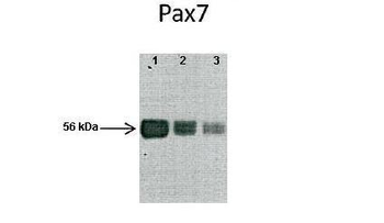 PAX7 Rabbit Polyclonal Antibody