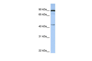 PSMD6 Rabbit Polyclonal Antibody