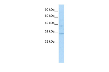 SIRT6 Rabbit Polyclonal Antibody