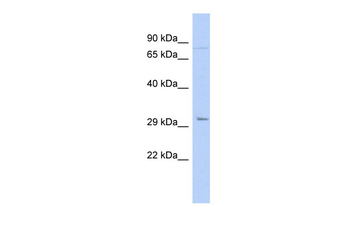 PITX2 Rabbit Polyclonal Antibody