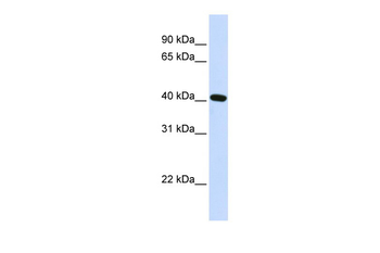 PITX2 Rabbit Polyclonal Antibody