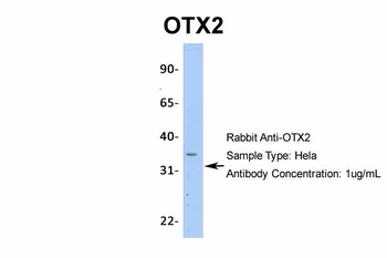 OTX2 Rabbit Polyclonal Antibody