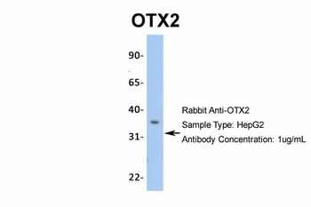 OTX2 Rabbit Polyclonal Antibody