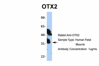 OTX2 Rabbit Polyclonal Antibody