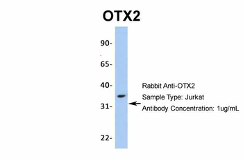 OTX2 Rabbit Polyclonal Antibody