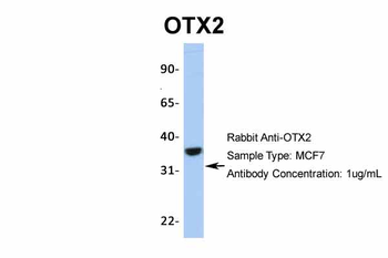 OTX2 Rabbit Polyclonal Antibody