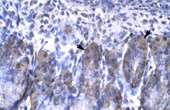 OTX2 Rabbit Polyclonal Antibody
