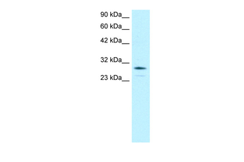 OTX2 Rabbit Polyclonal Antibody