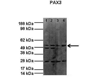 PAX3 Rabbit Polyclonal Antibody