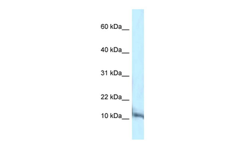 Pcbd1 Rabbit Polyclonal Antibody