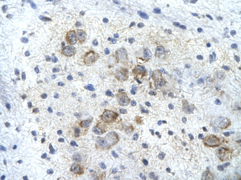 PSMD14 Rabbit Polyclonal Antibody