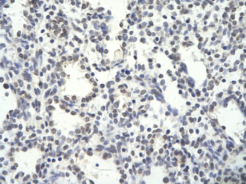 PSMD14 Rabbit Polyclonal Antibody