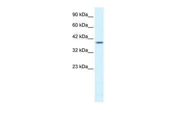 PSMD14 Rabbit Polyclonal Antibody