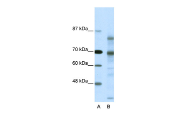 NCOR2 Rabbit Polyclonal Antibody
