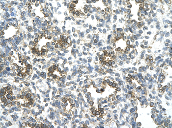SUV39H1 Rabbit Polyclonal Antibody